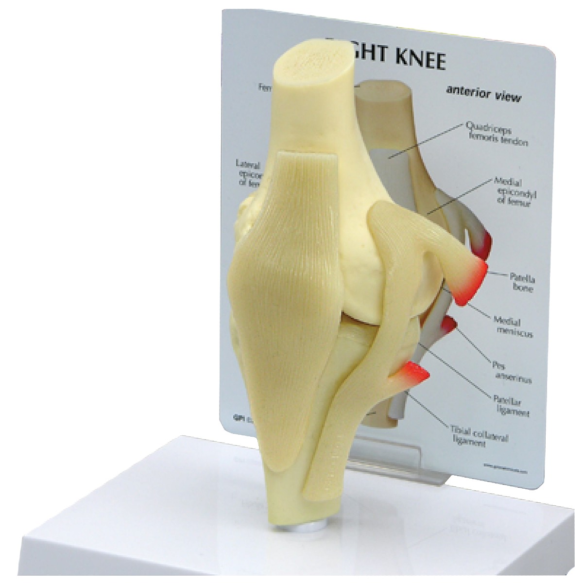 Knee Model (Right) | Medco Sports Medicine