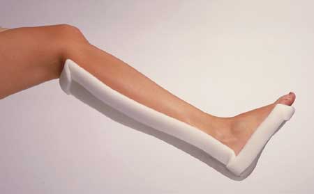3M Scotchcast One Step Splint
