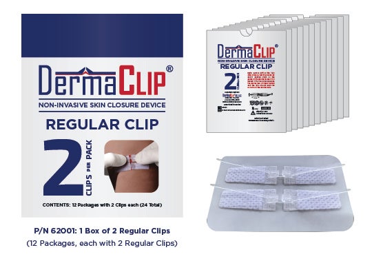 DermaClip Non-Invasive Skin Closure