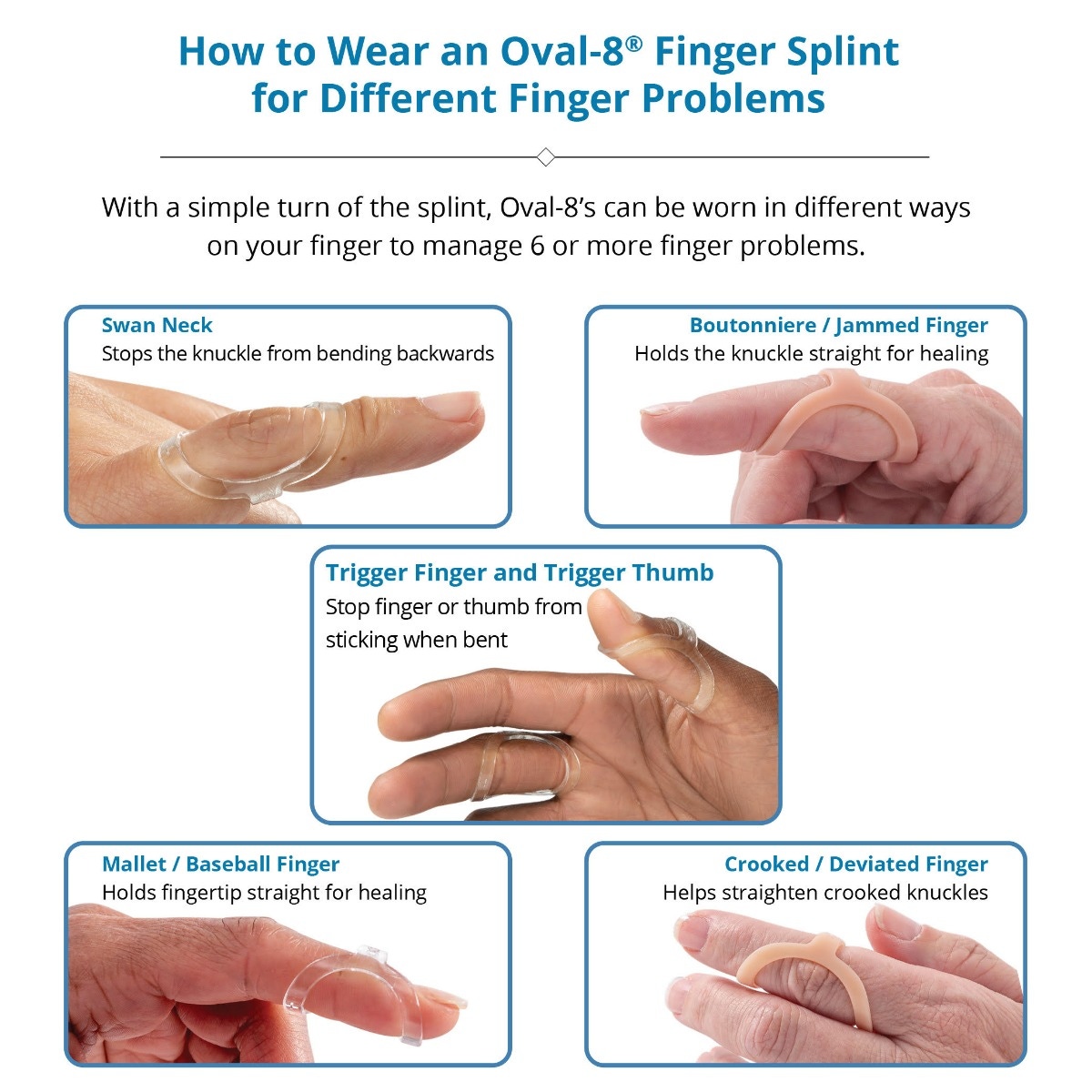 Oval-8 Splints