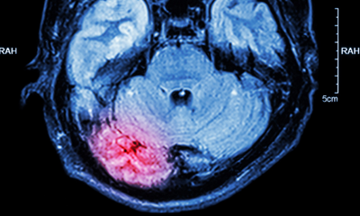 The Top Products and Innovations for Athletic Trainers