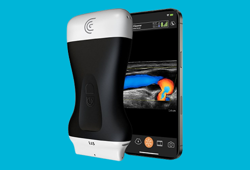 Clarius Ultrasound